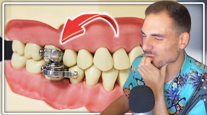 ¡Un candado en la boca para adelgazar! ¿Estamos locos o qué?